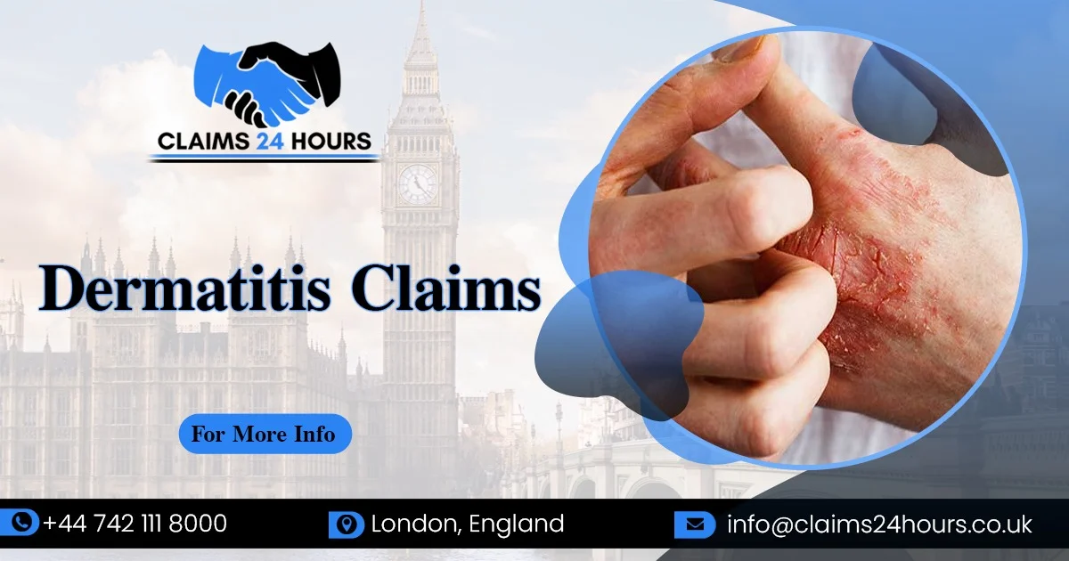 Dermatitis Claims