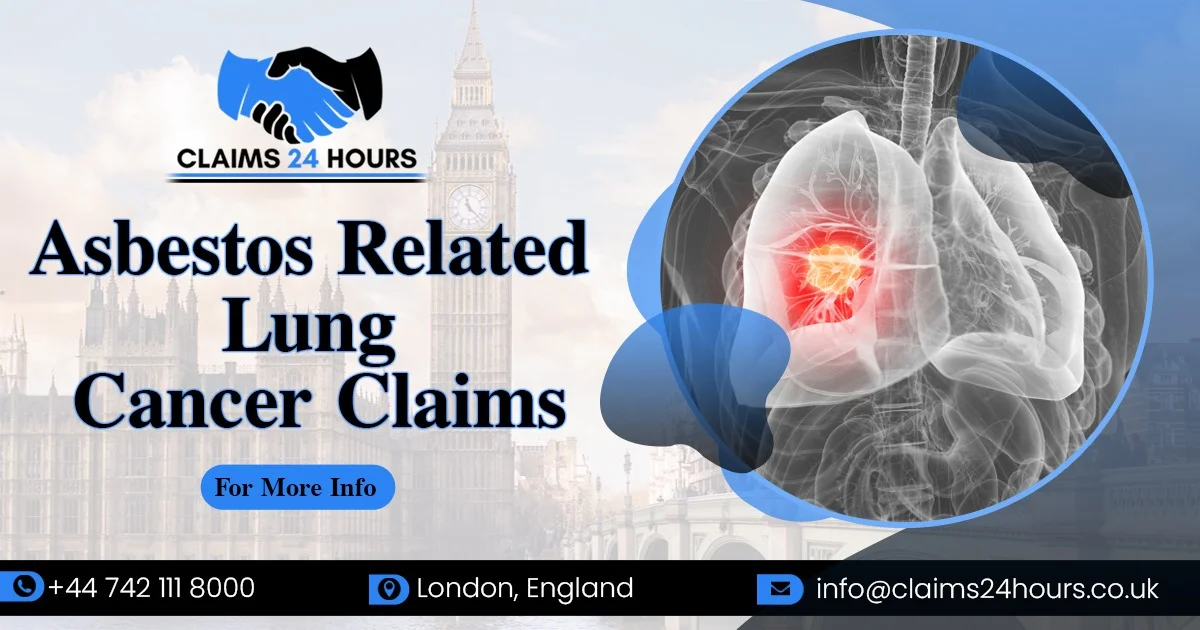 Asbestos Related Lung Cancer Claims